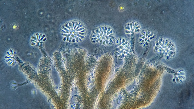 bacteria under microscope