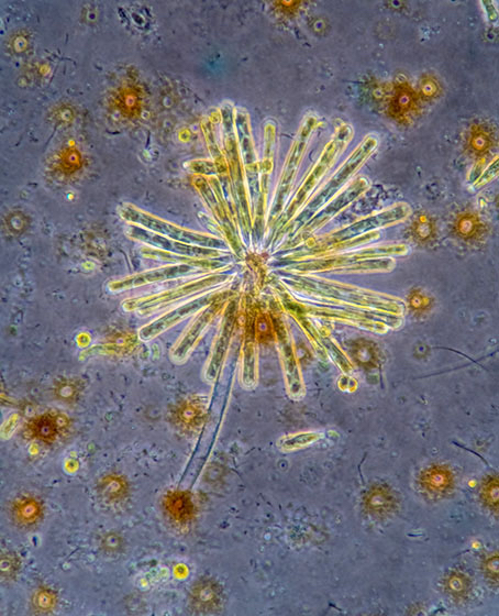 bacteria under microscope