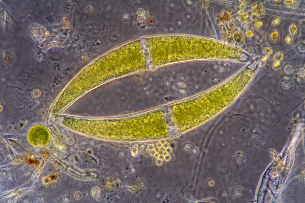 Algae under microscope