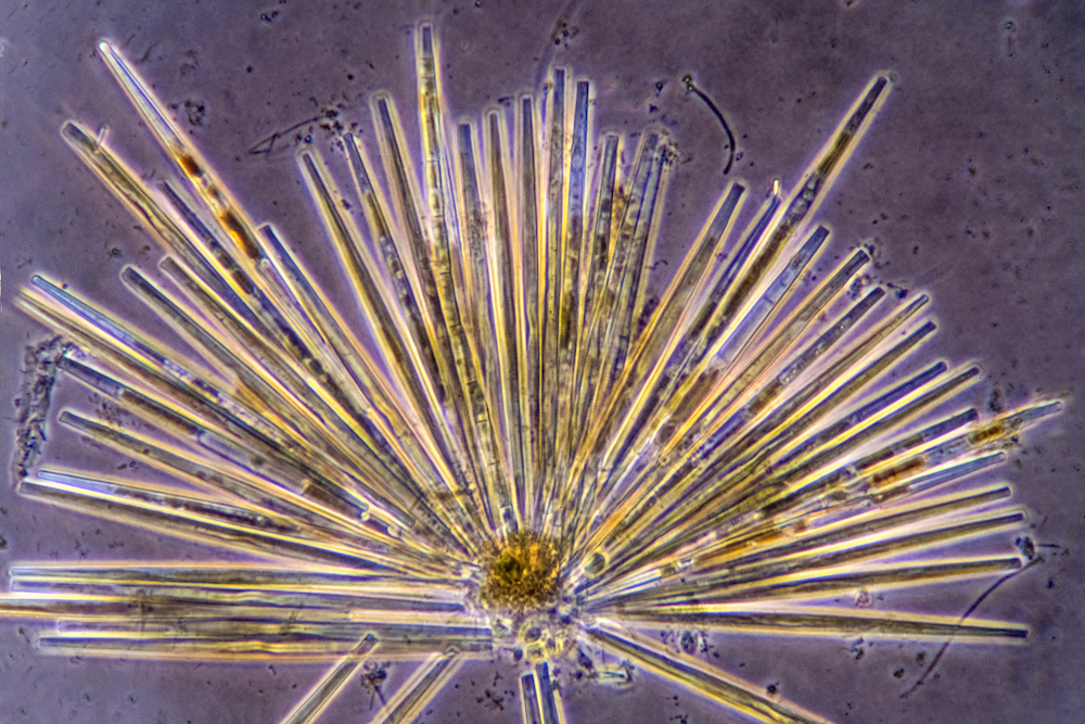 Algae under microscope