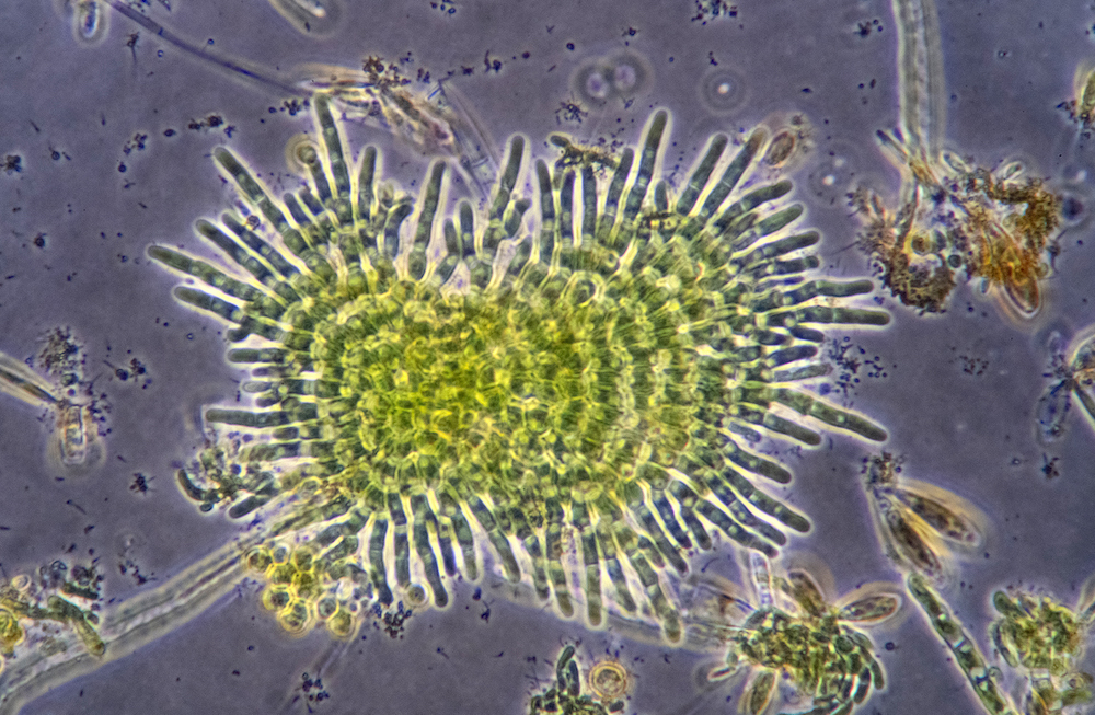 Algae under microscope