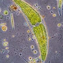 bacteria under microscope