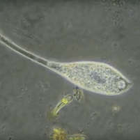 Protozoa under microscope