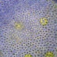 Algae under microscope
